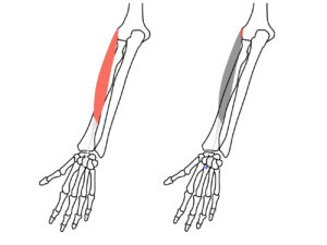 短橈側手根伸筋（たんとうそくしゅこんしんきん）の起始と停止