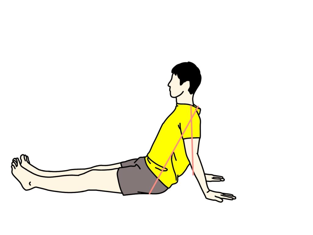 上腕二頭筋の妊娠線を日焼けで隠すことはできますか?